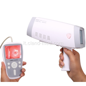 Fotocamera digitale Full HD palmare per colposcopio della vagina